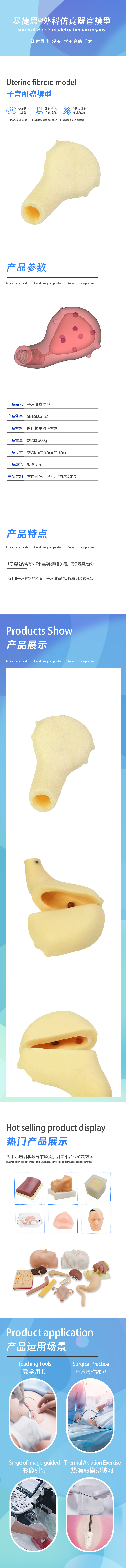 子宫肌瘤模型.jpg